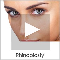 rhinoplasty results san diego