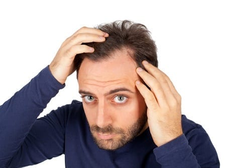 hair loss san diego treatment