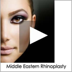 middle eastern rhinoplasty-results-san-diego/