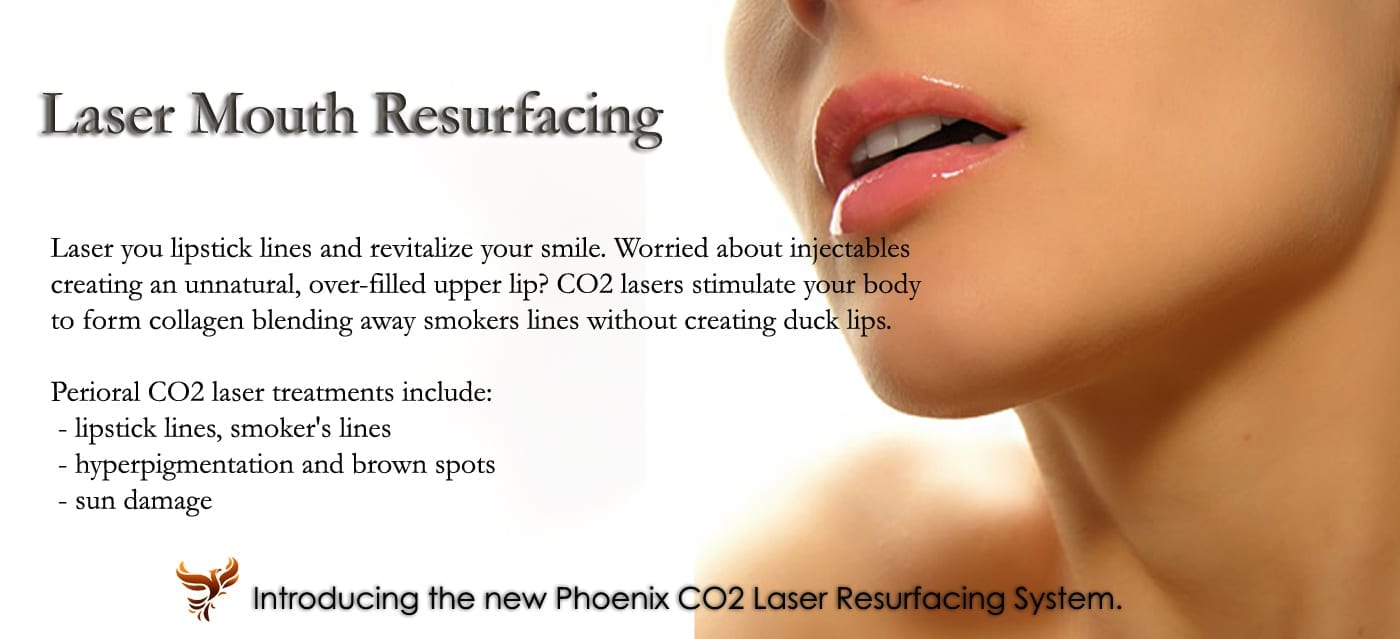 Fractionated CO2 Laser San Diego - Restore SD Plastic Surgery