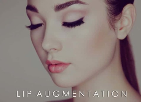 lip filler san diego ca