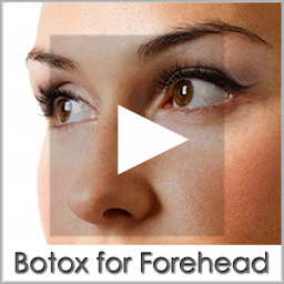 botox forehead before after