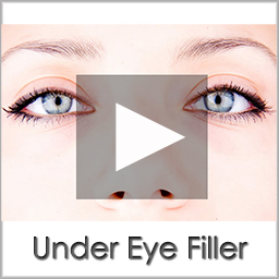 under eye filler