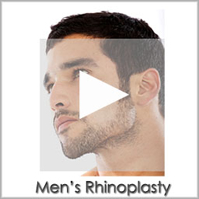 men's rhinoplasty san diego