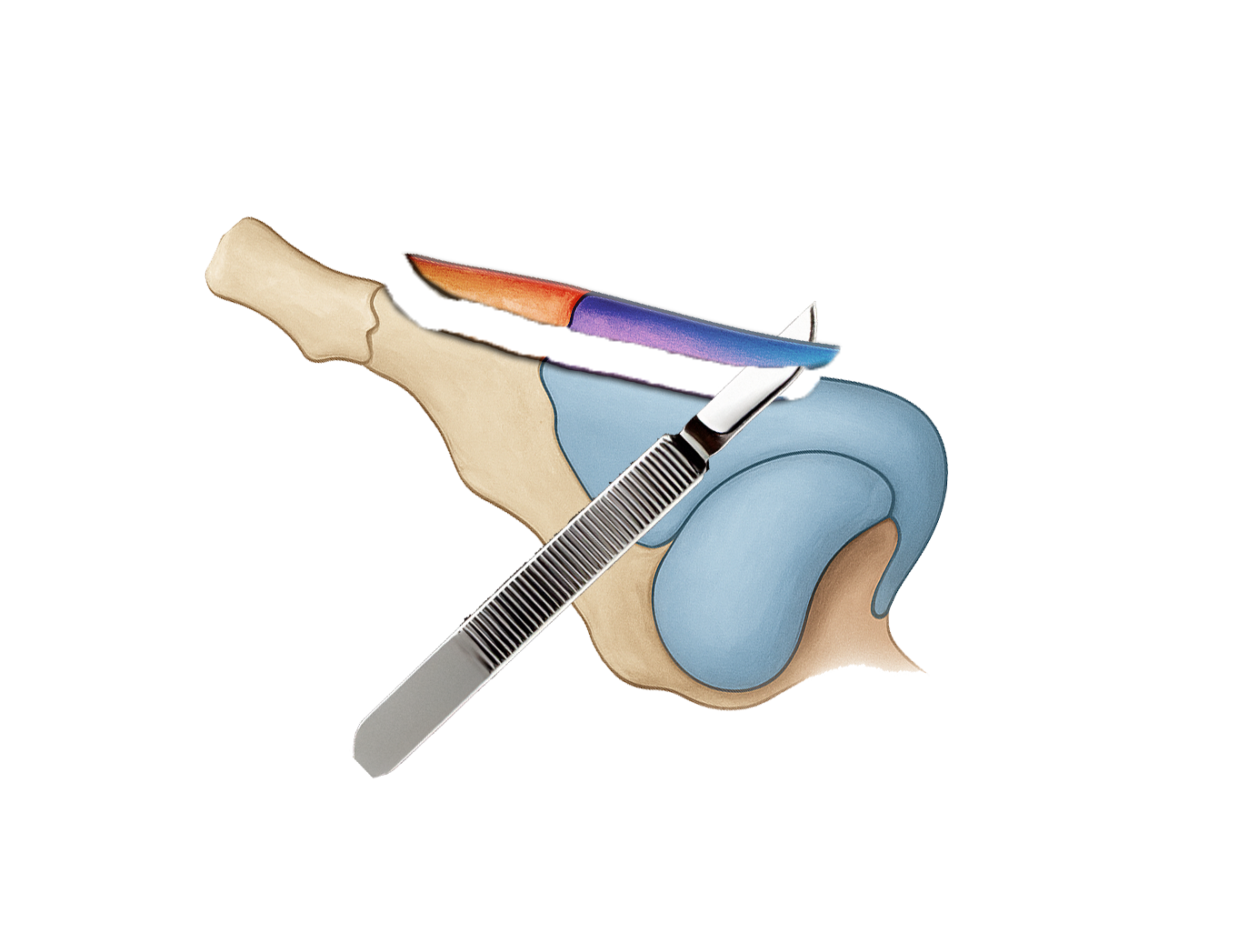 健康・医学 Preservation Rhinoplasty Dorsal Preservation Rhinoplasty | Dr. Kolstad - San Diego