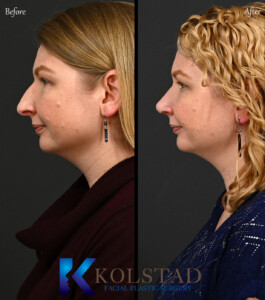 san diego dorsal preservation
