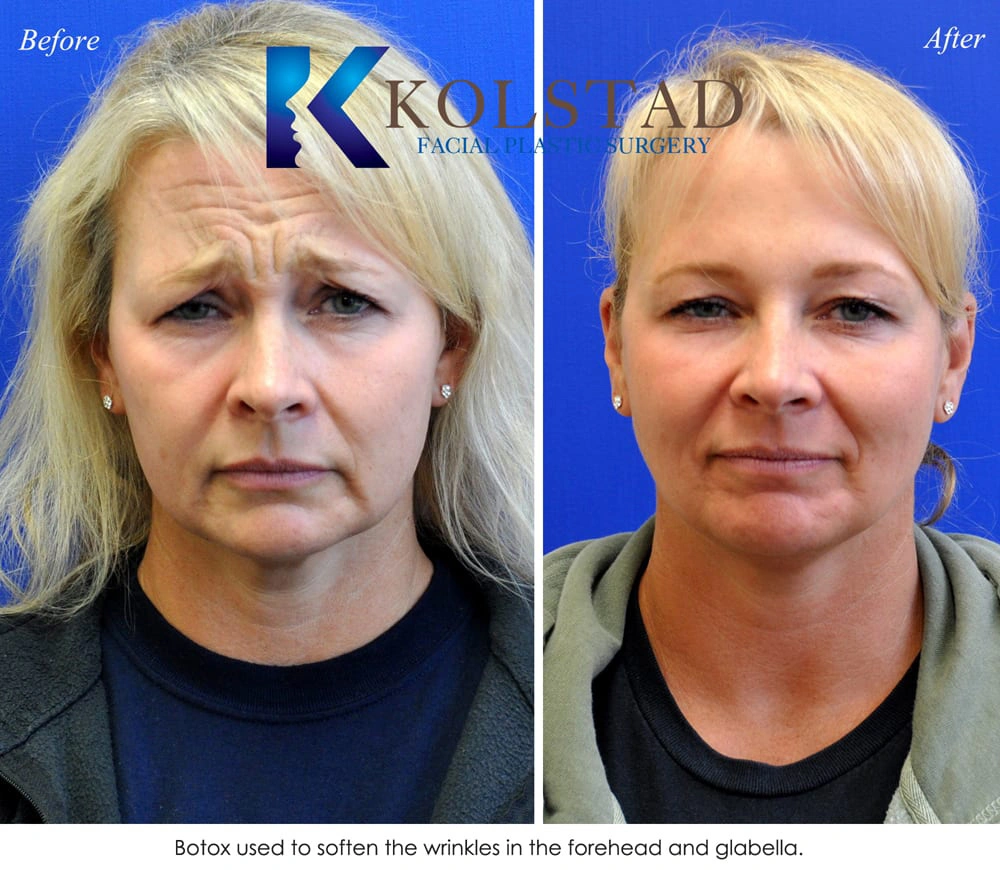 http://botox-san-diego-805
