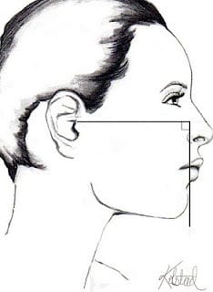 2-chin-analysis
