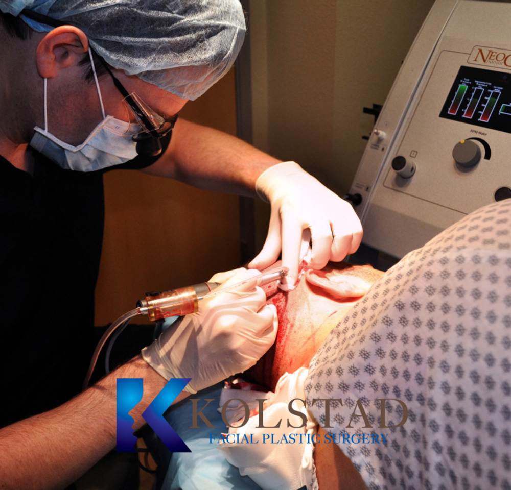 dr kolstad hair transplant